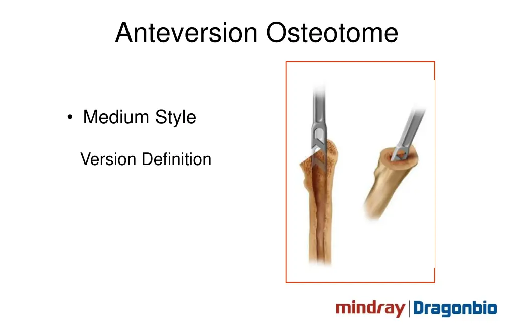 anteversion osteotome