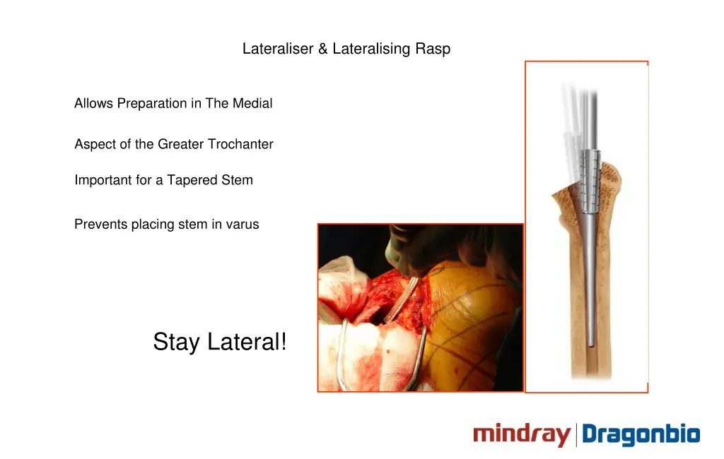 lateraliser lateralising rasp