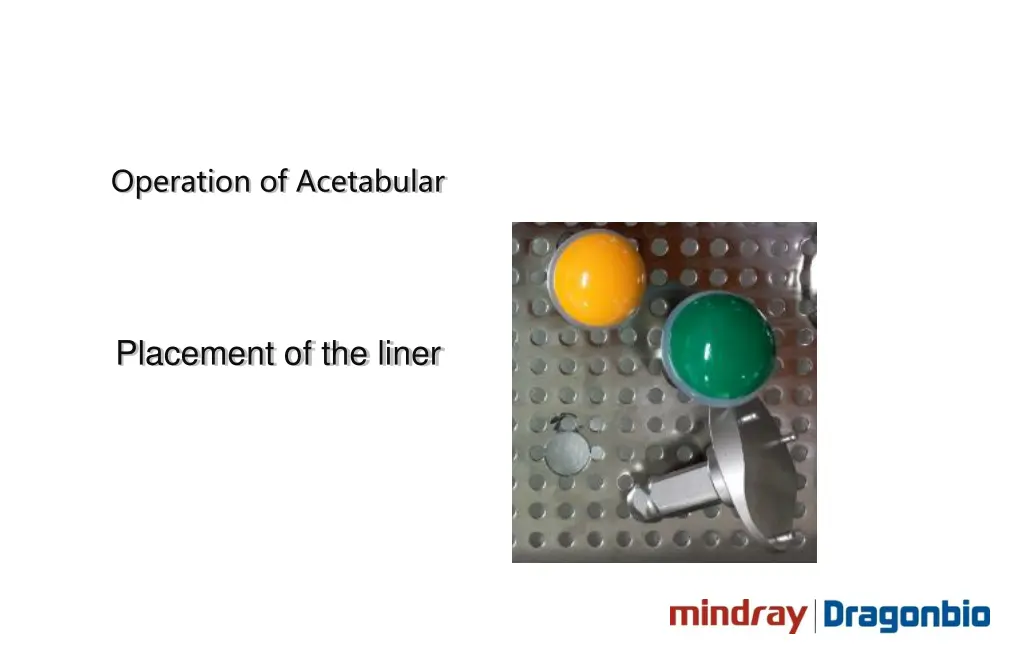 operation of acetabular 4