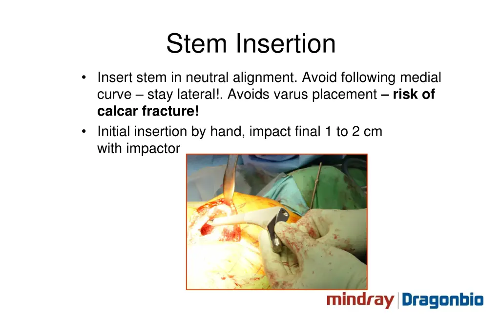 stem insertion