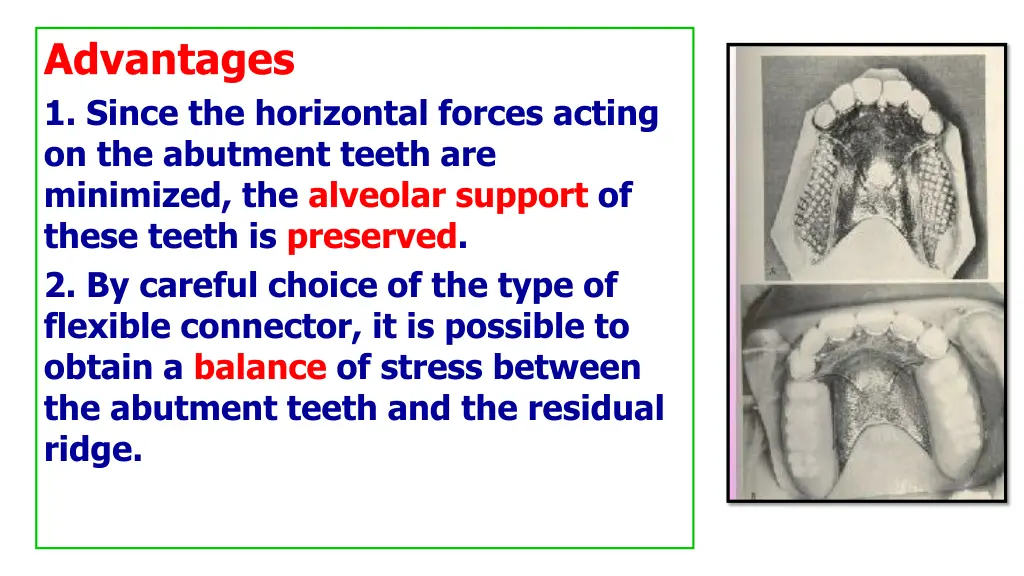 advantages 1 since the horizontal forces acting