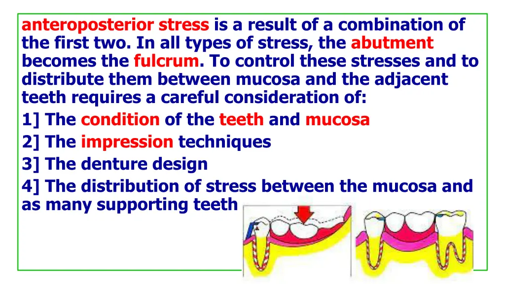 anteroposterior stress is a result