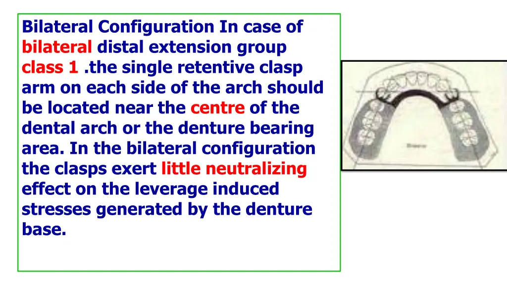 bilateral configuration in case of bilateral