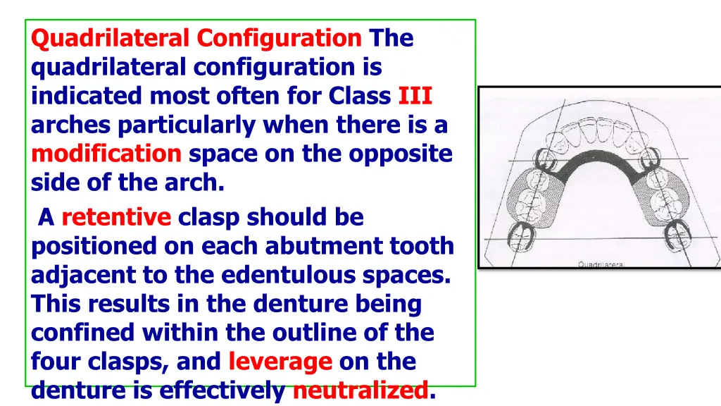 quadrilateral configuration the quadrilateral