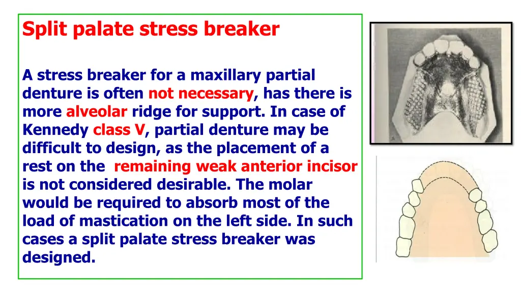 split palate stress breaker