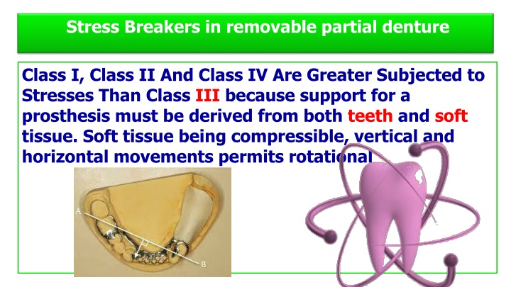 stress breakers in removable partial denture