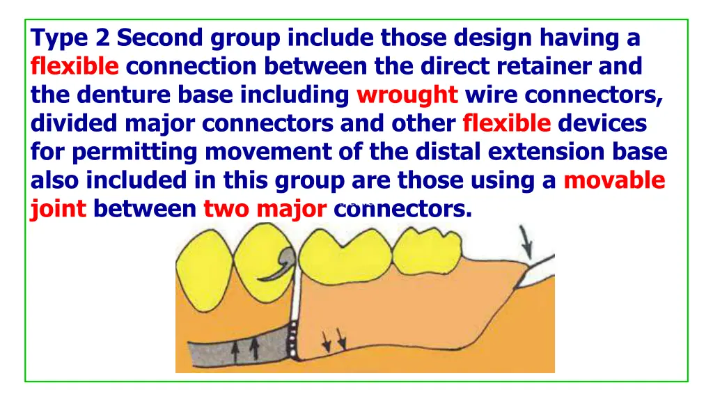 type 2 second group include those design having