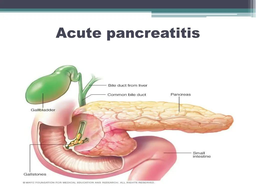 acute pancreatitis 1