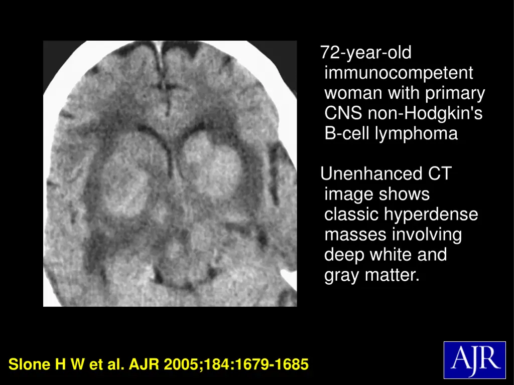 72 year old immunocompetent woman with primary