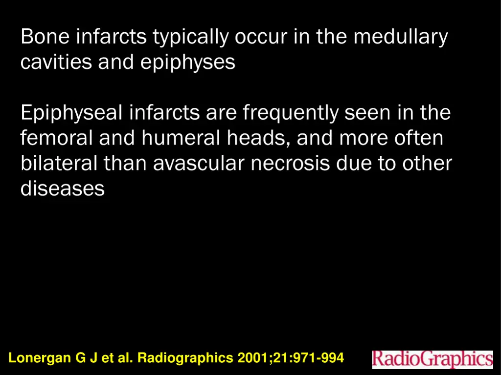 bone infarcts typically occur in the medullary