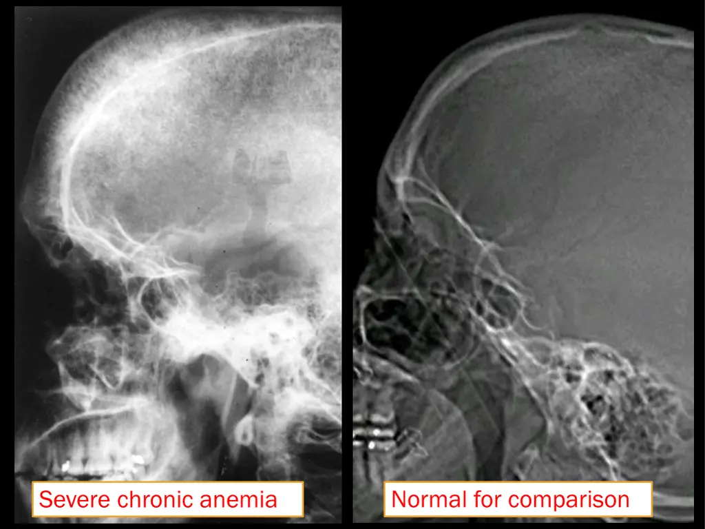 file skull x ray lateral view jpg