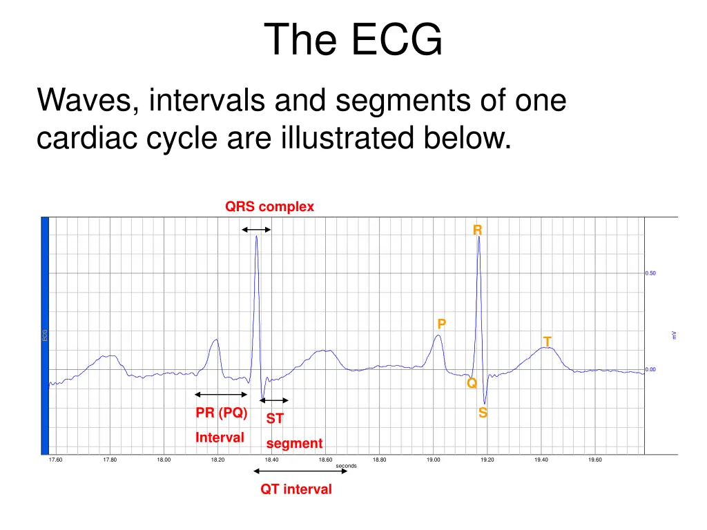 the ecg 1