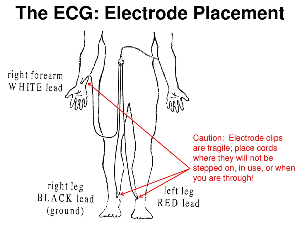 the ecg electrode placement