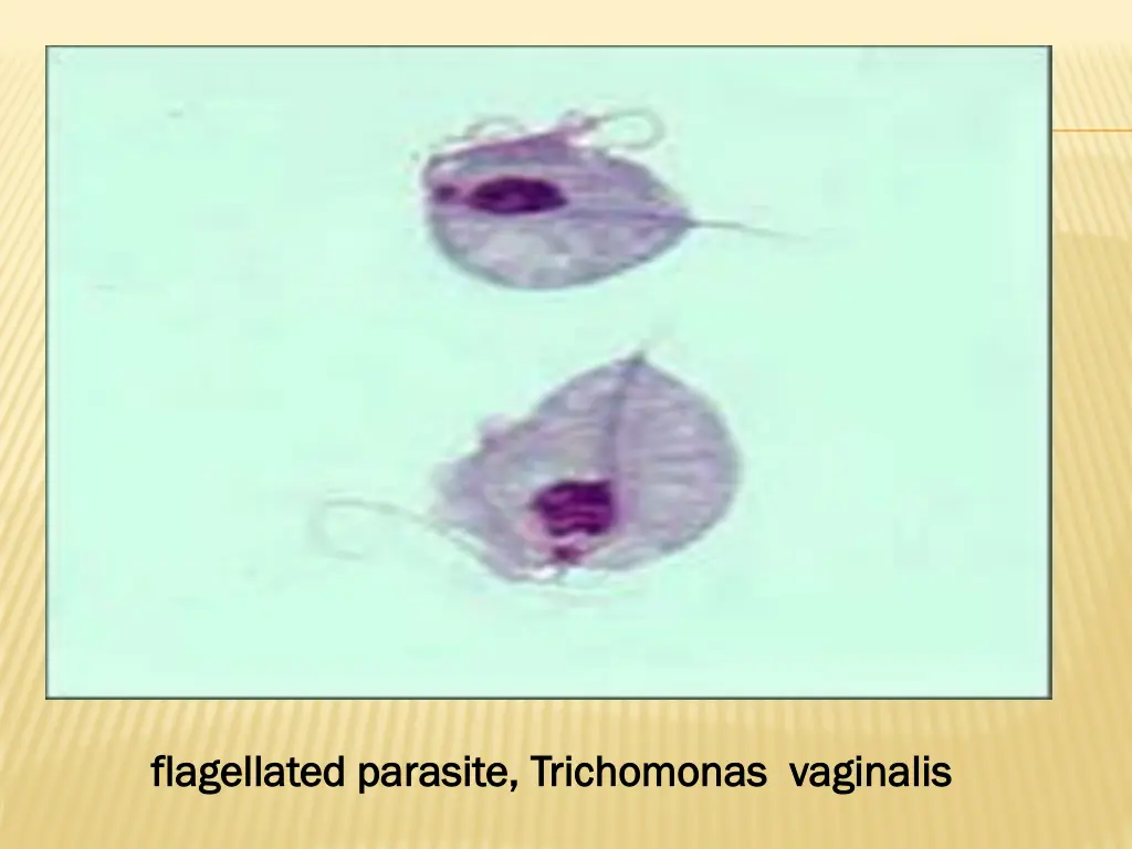 trichomonas vaginalis