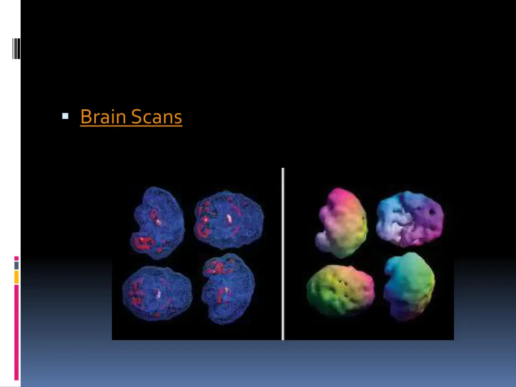 brain scans