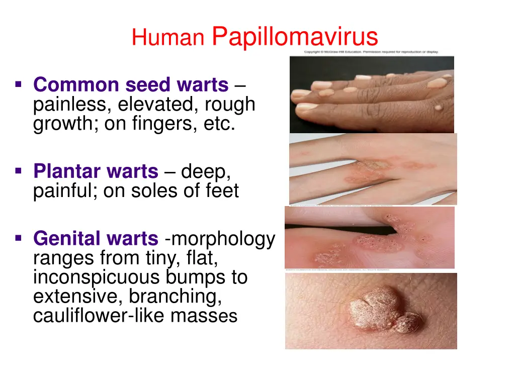 human papillomavirus 1