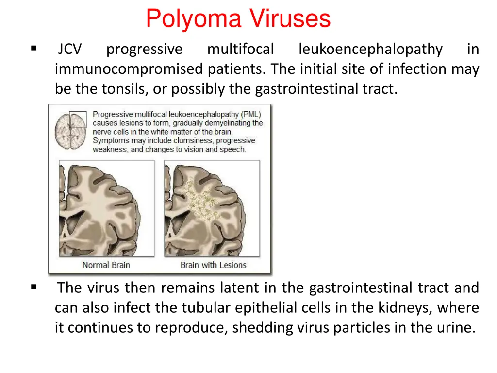 polyoma viruses 2