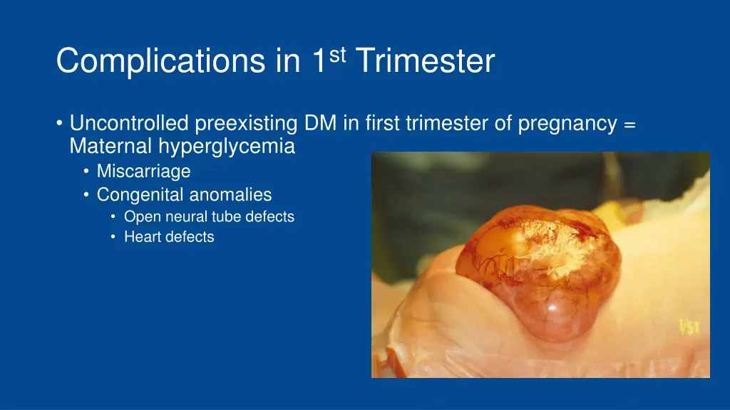 complications in 1 st trimester