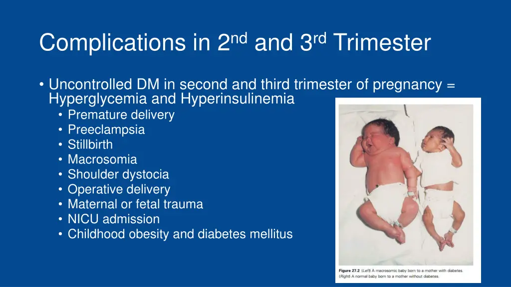 complications in 2 nd and 3 rd trimester 1