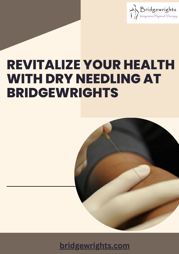 revitalize your health with dry needling