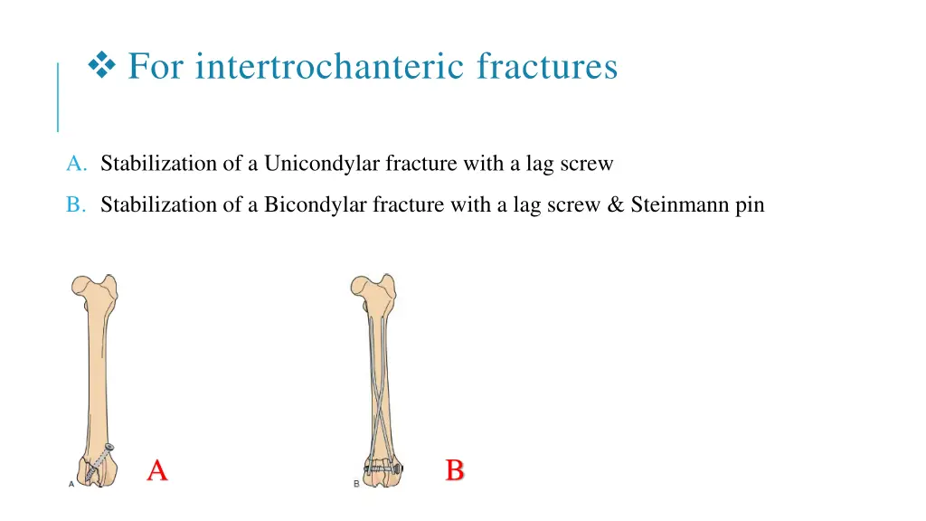 for intertrochanteric fractures