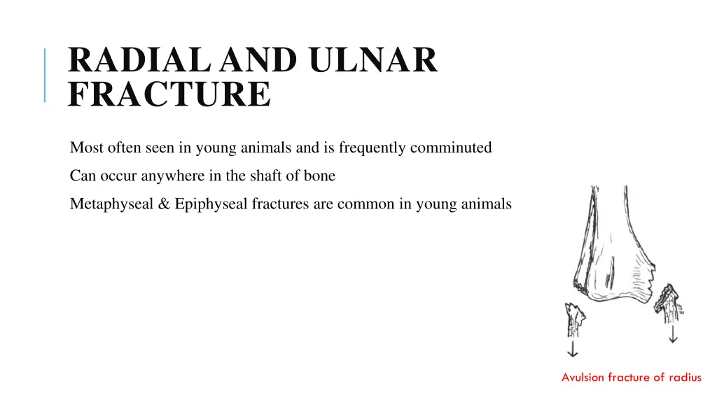 radial and ulnar fracture