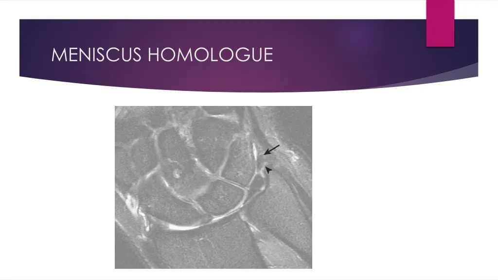 meniscus homologue