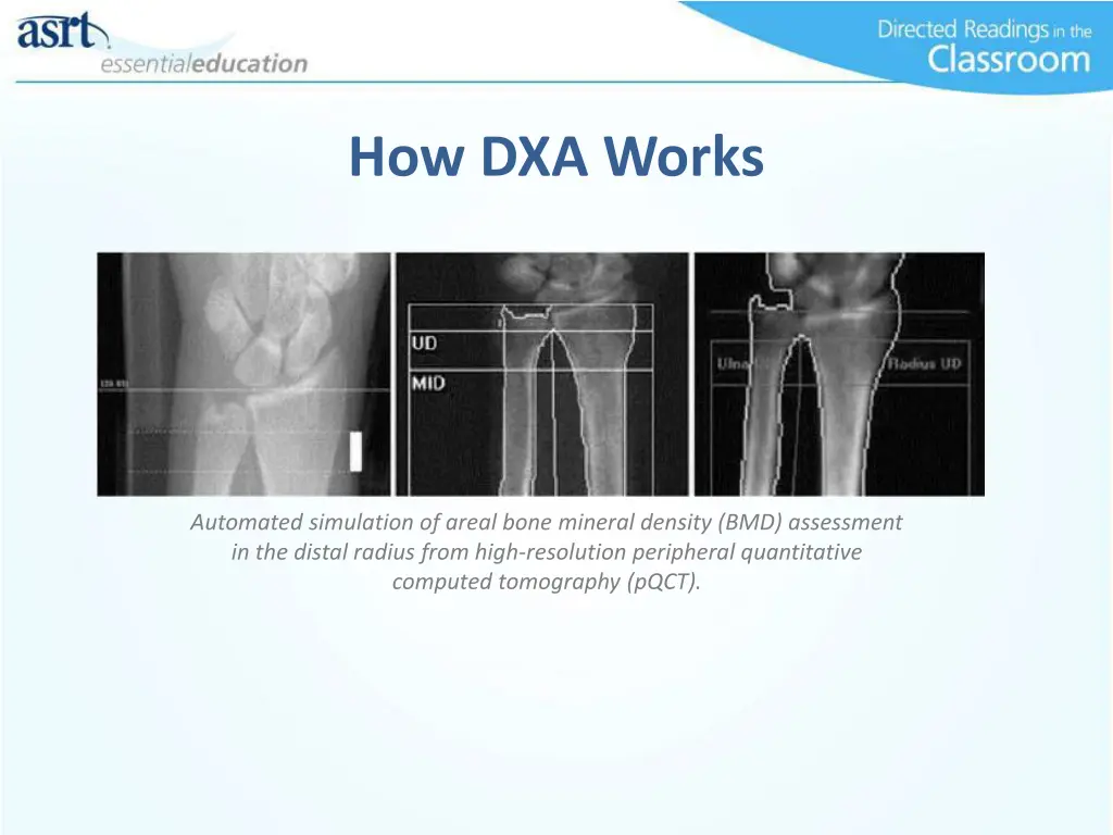 how dxa works 1