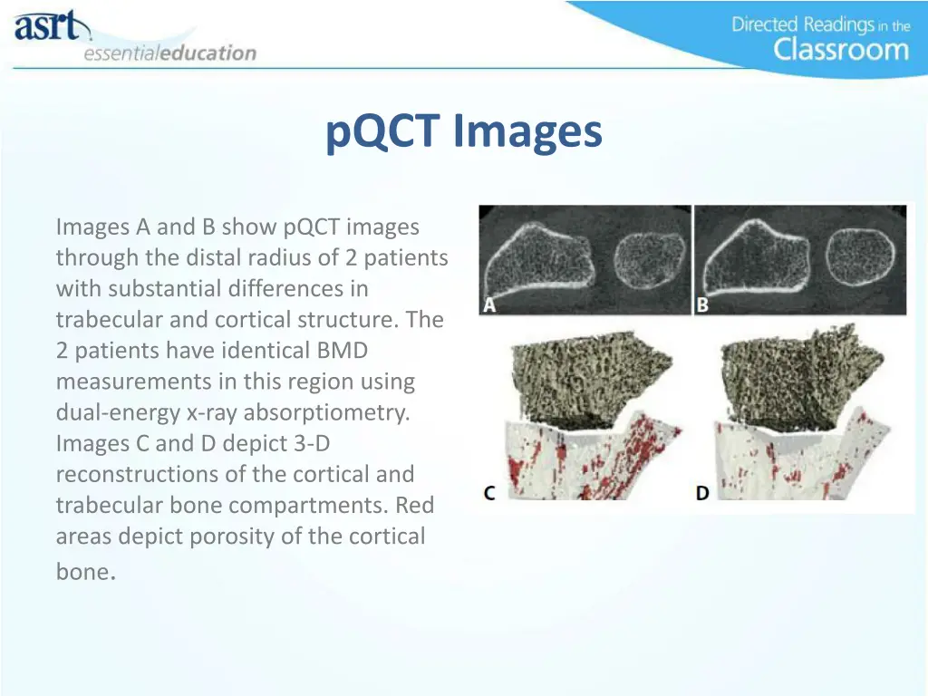 pqct images