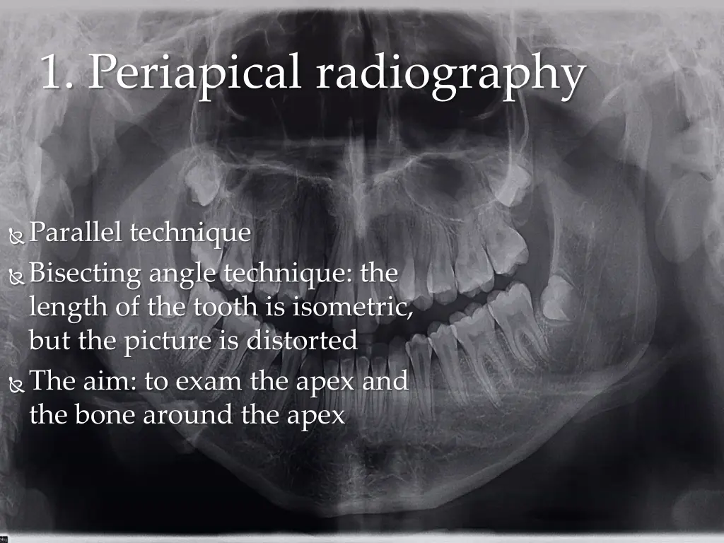 1 periapical radiography 2