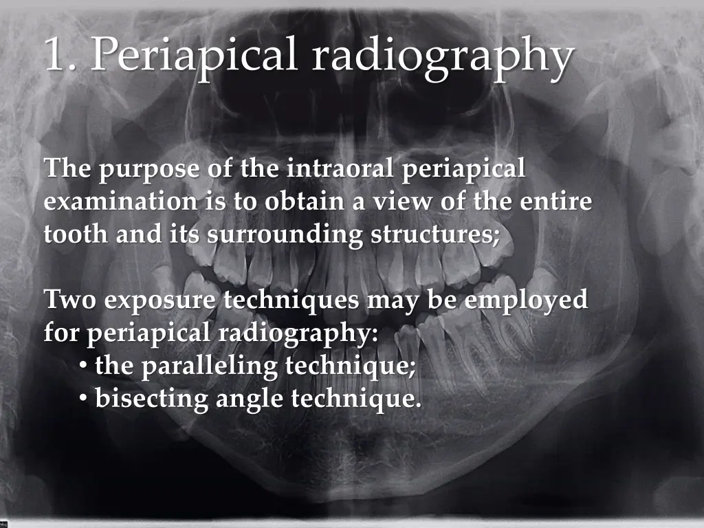 1 periapical radiography