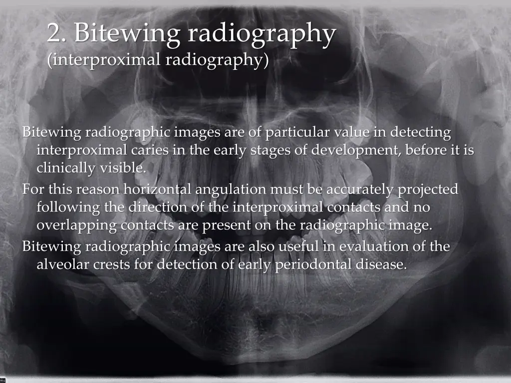 2 bitewing radiography interproximal radiography