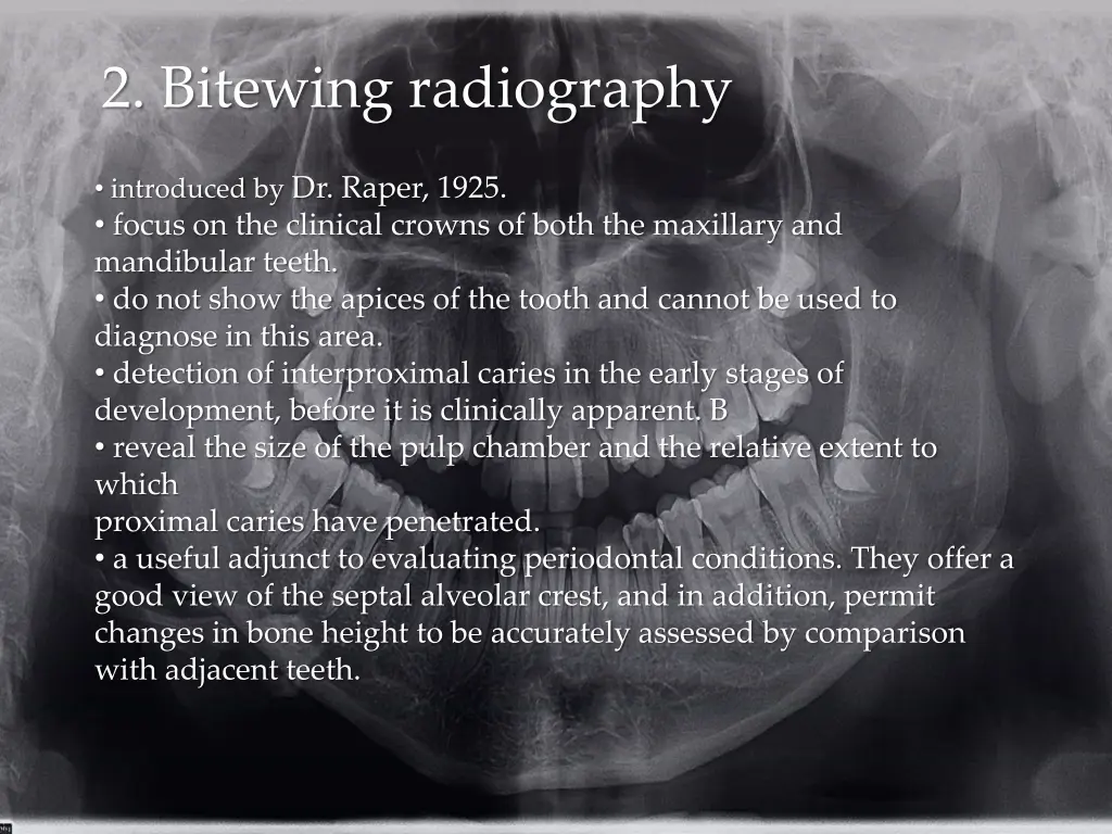 2 bitewing radiography