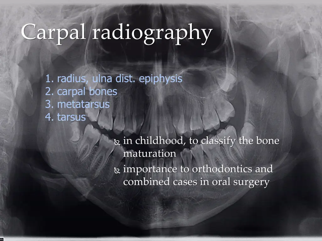 carpal radiography