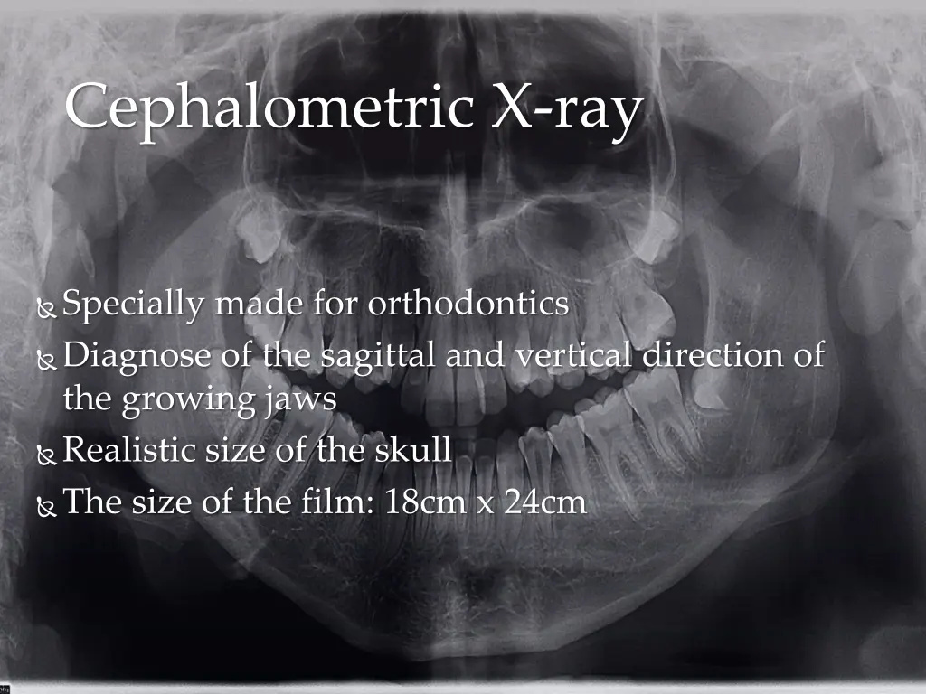 cephalometric x ray