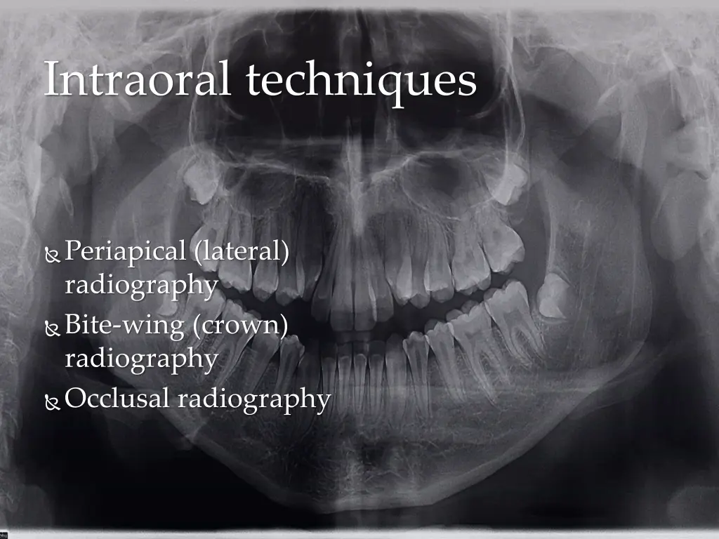 intraoral techniques