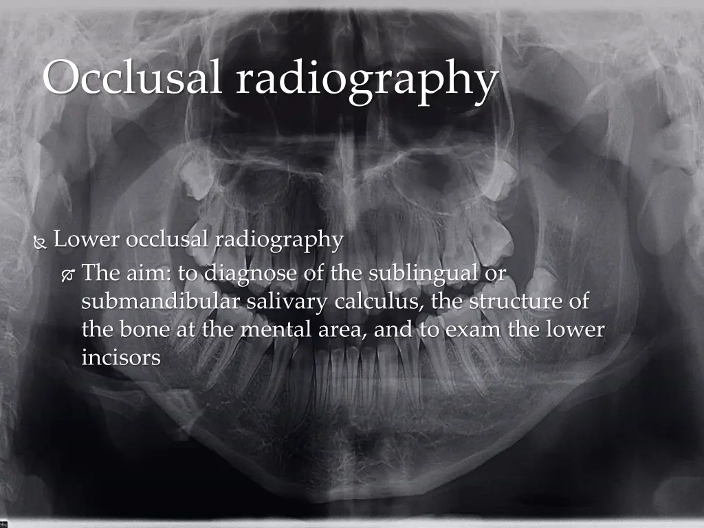 occlusal radiography 1