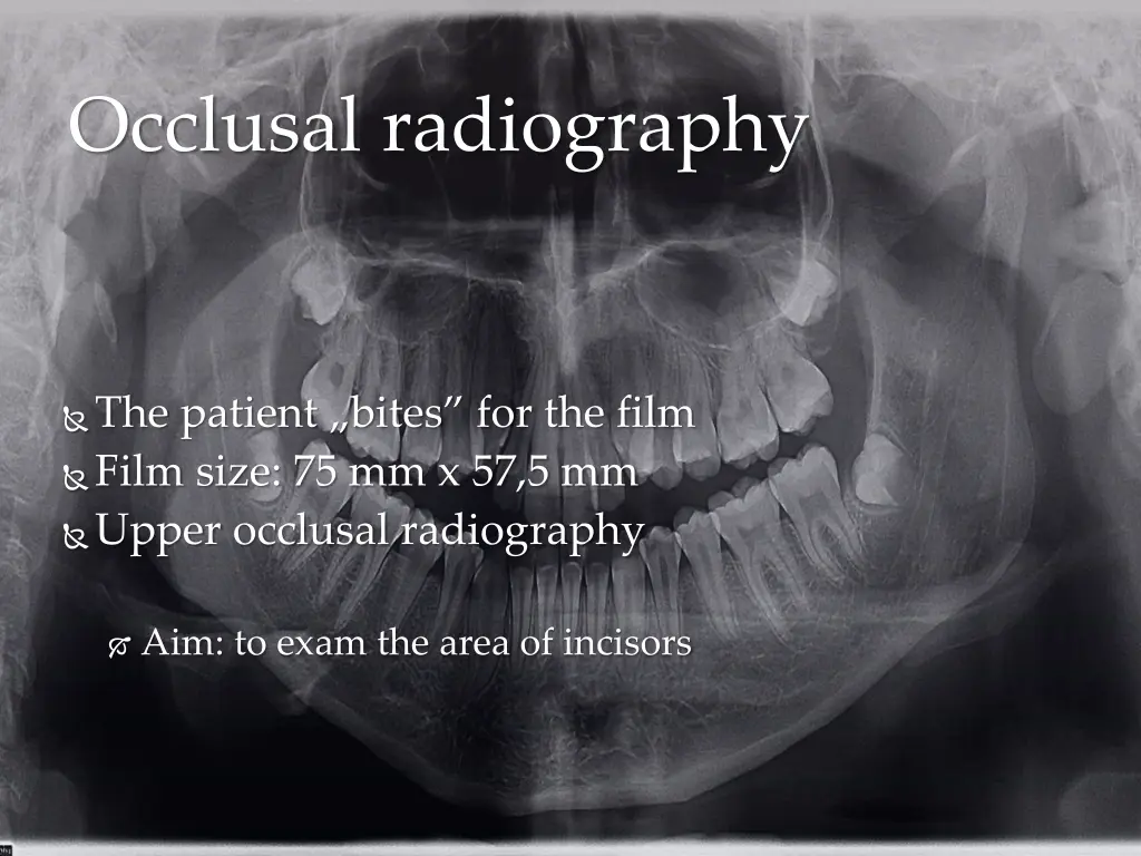 occlusal radiography