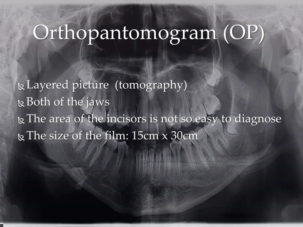 orthopantomogram op