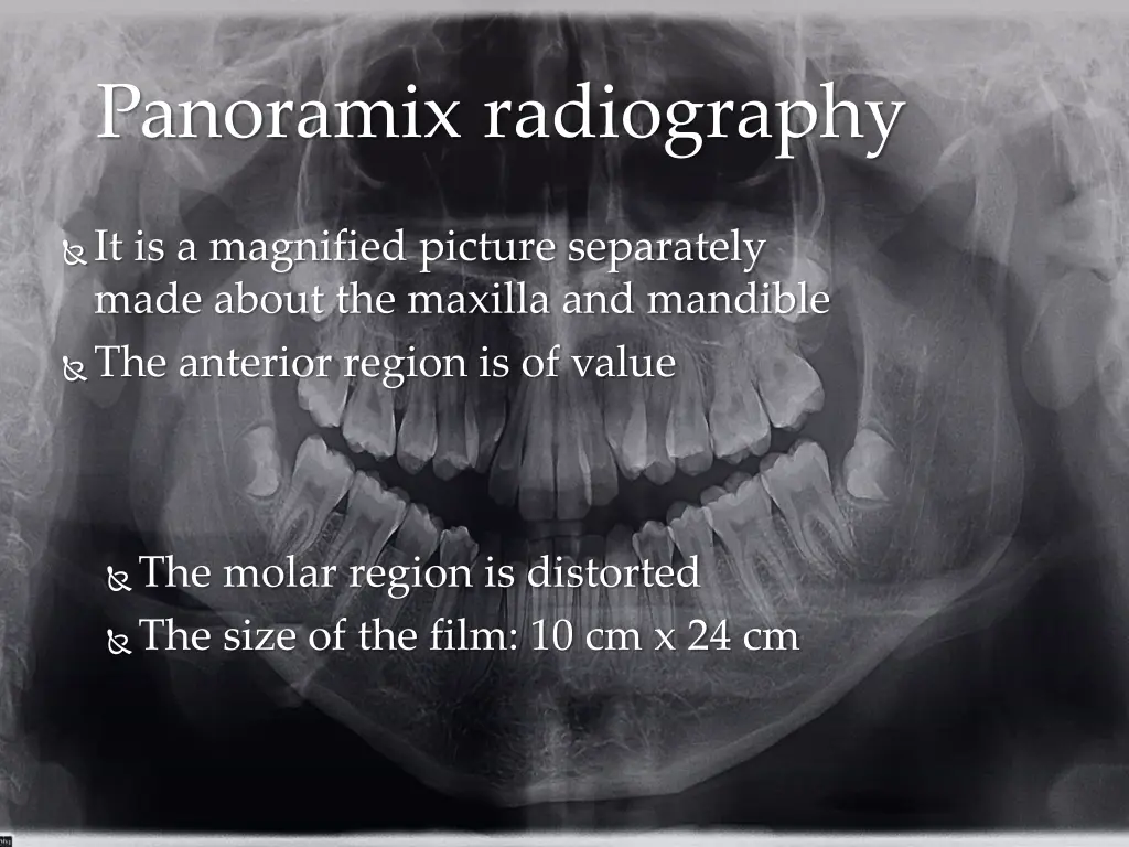 panoramix radiography