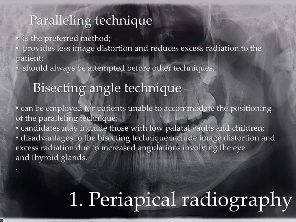 paralleling technique