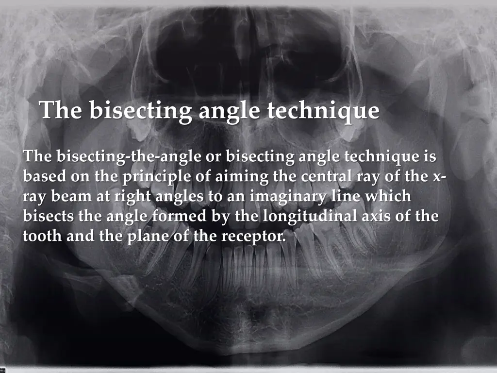 the bisecting angle technique