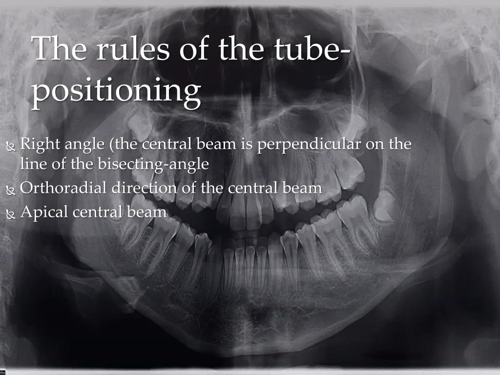 the rules of the tube positioning