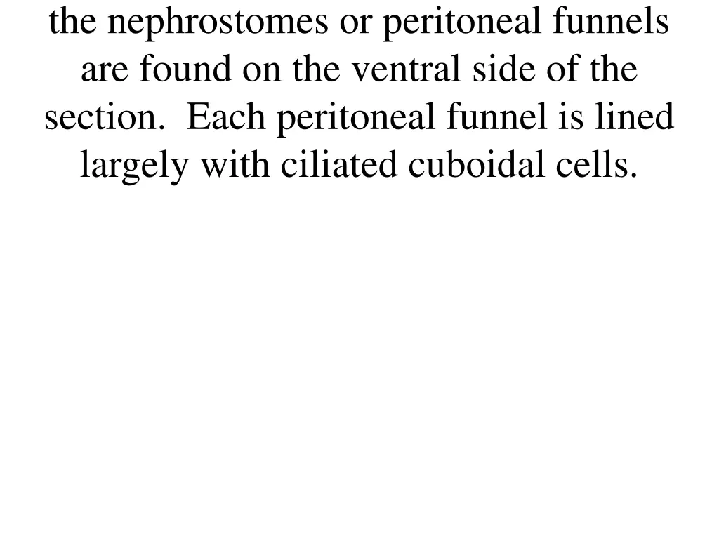 the nephrostomes or peritoneal funnels are found