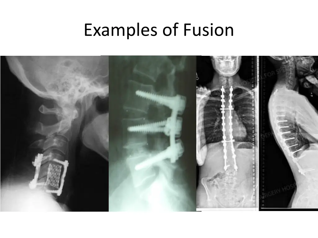 examples of fusion