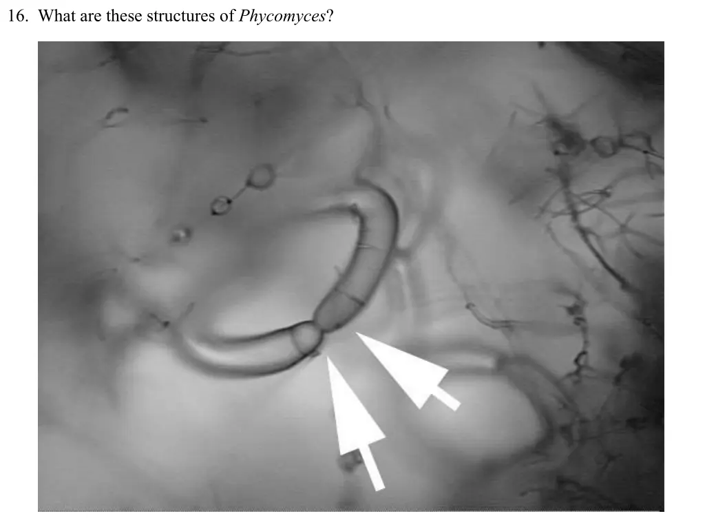 16 what are these structures of phycomyces