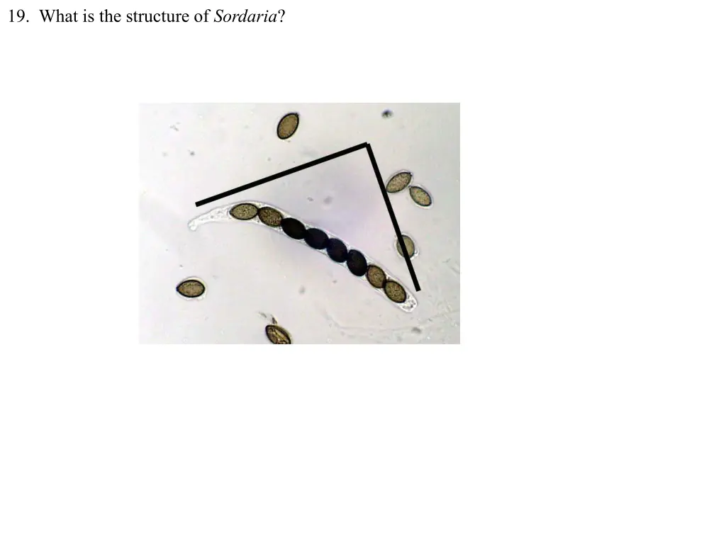 19 what is the structure of sordaria