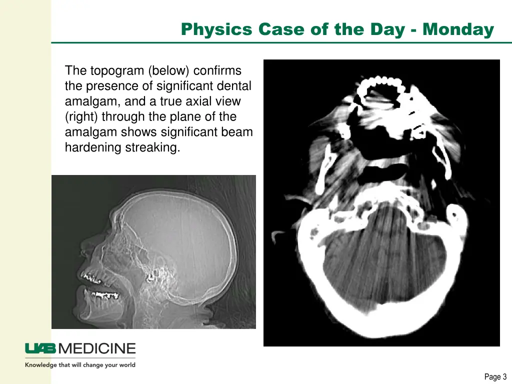 physics case of the day monday 2