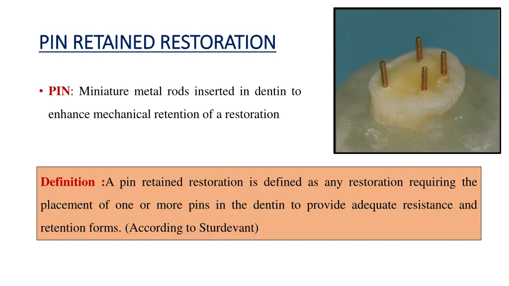 pin retained restoration pin retained restoration 1