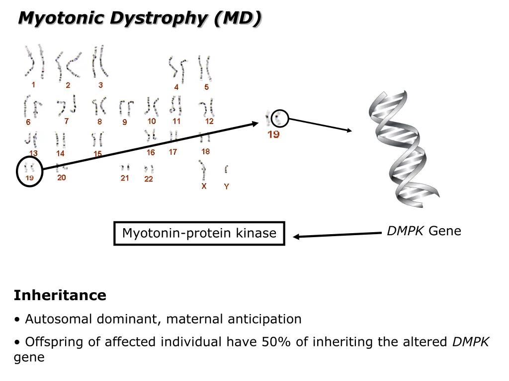 myotonic dystrophy md